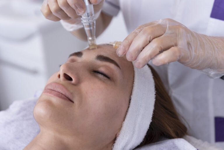 Microneedling
